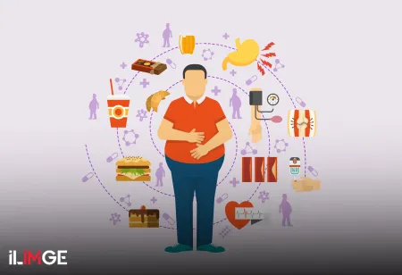 Çağımızın Hastalığı Obezite