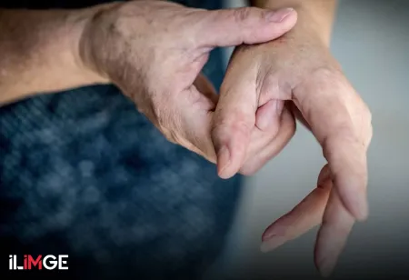 Yabancı El Sendromu(YES)