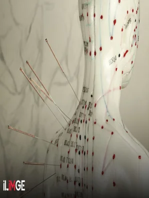 Klasik Çin Akupunkturu ve Kısa Tarihi